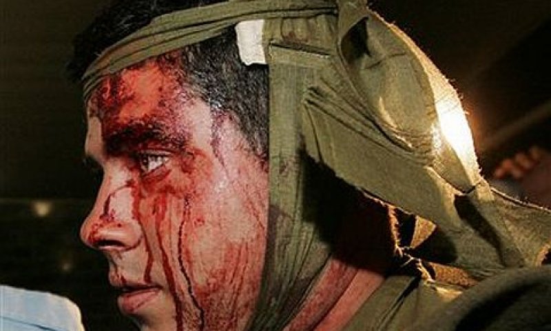 חייל שנפצע בעזה במבצע עופרת יצוקה [צילום אילוסטרציה: AP]