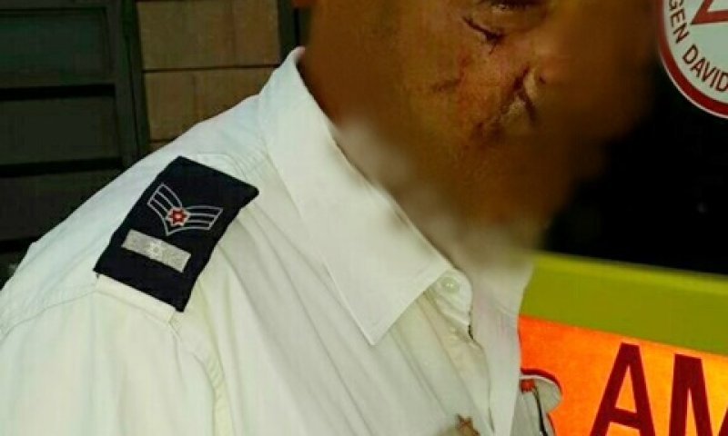 החובש הפצוע לאחר התקרית [צילום: דוברות מד"א]
