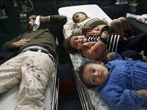 ילדים פלשתינים שנפצעו בתקיפה [צילום: AP]