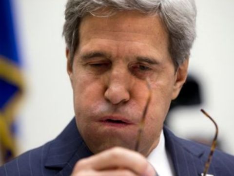 קרי. צעדים מוגדרים [צילום: AP]