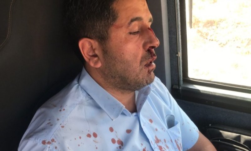 נהג האוטובוס לאחר שהותקף. פונה לבית חולים [צילום: אגד תעבורה]