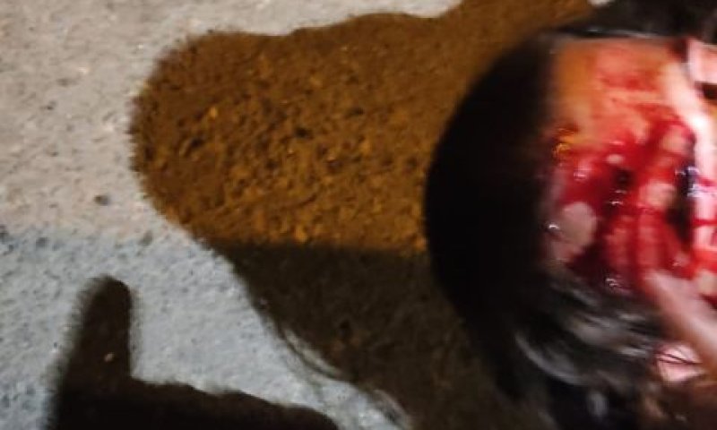 נער יהודי שנפגע מאבן בראשו בשכונת שמעון הצדיק