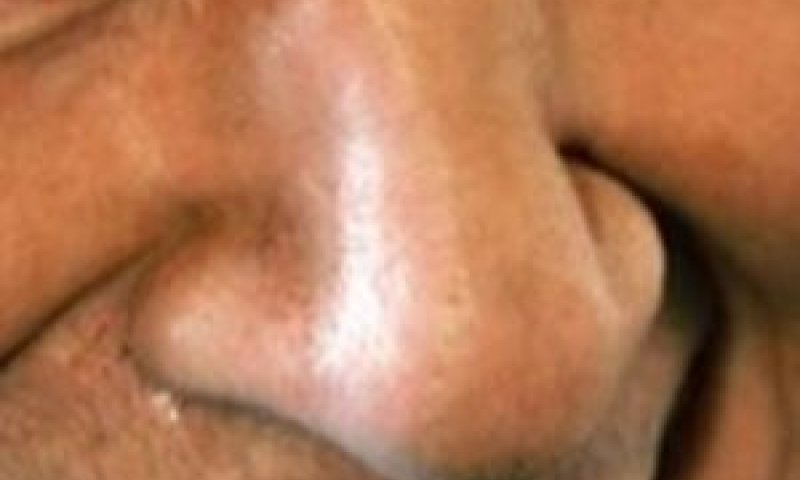 לא זרקה אותו בגלל האף [צילום: AP]
