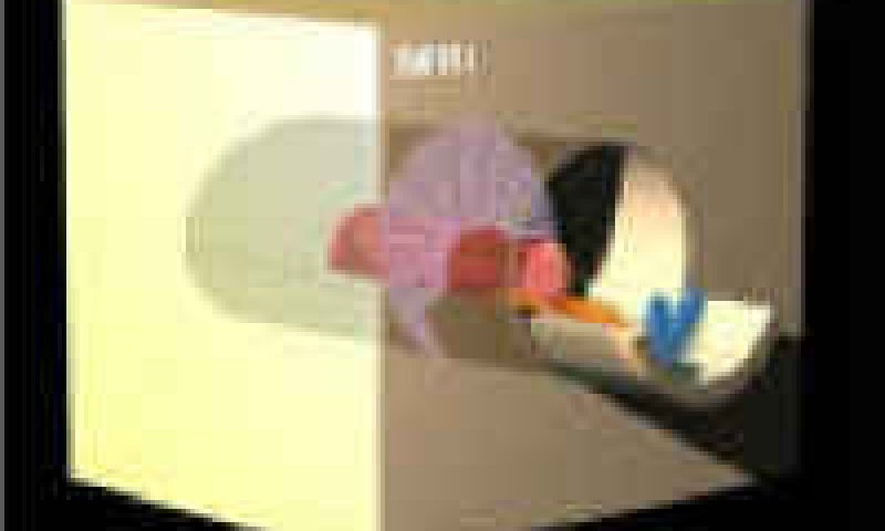 MRI