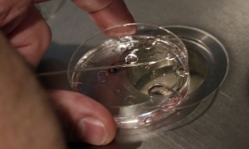 יש לוודא מהו רצונו של המת [צילום: ריצ'רד דרו, AP]