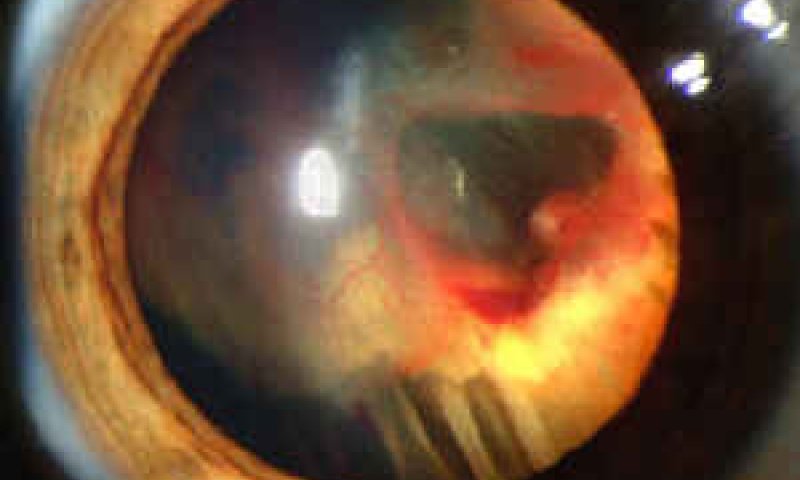 [צילום: National Eye Institute, National Institutes of Health ]