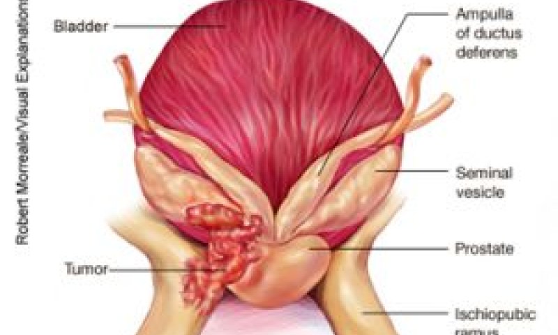 [צילום: האגודה האמריקנית לאונקולוגיה קלינית]