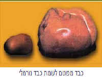 כבד מפוטם