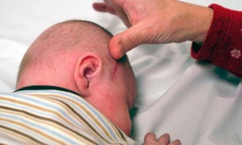 תינוק עם כף רגל במוח [צילום: AP]