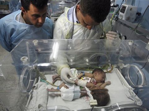התאומות הסיאמיות בבית החולים [צילום: AP]