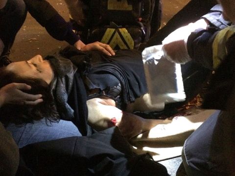 זוועה בפריז. נפגעת באתר הפיגוע [צילום: AP]