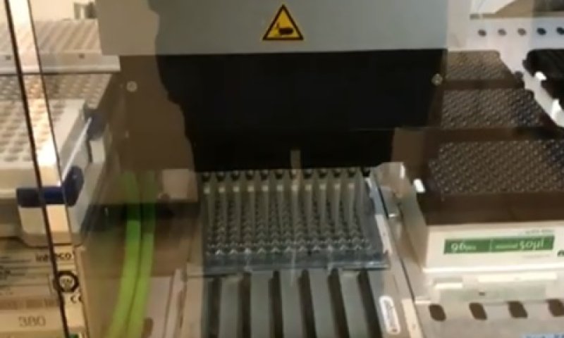 בדיקת הקורונה החדשה [צילום: האוניברסיטה העברית]