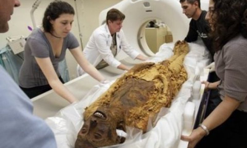 מומיה עוברת סריקת CT [צילום: AP]