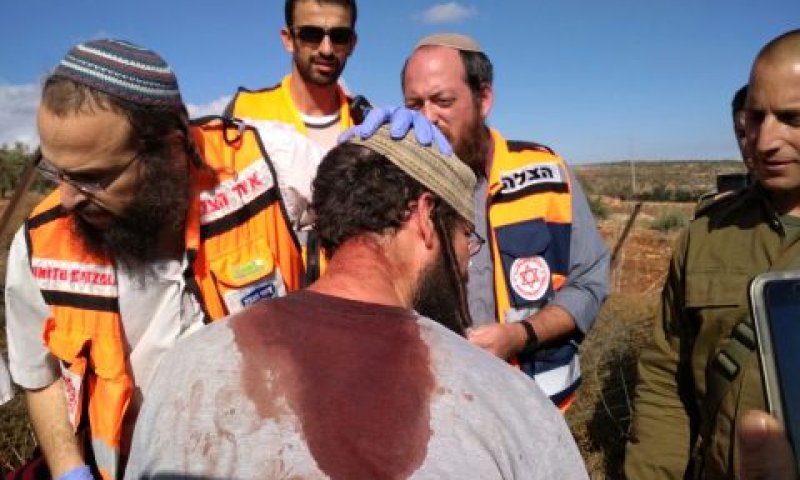 מלווה קבוצת הנערים נפצע בראשו