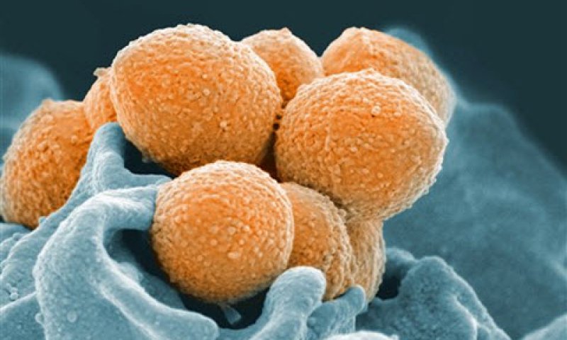 [צילום: National Institute of Allergy and Infectious Diseases via AP]