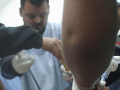 רופאים מנסים להציל את חיי חמוש החמאס [AP]