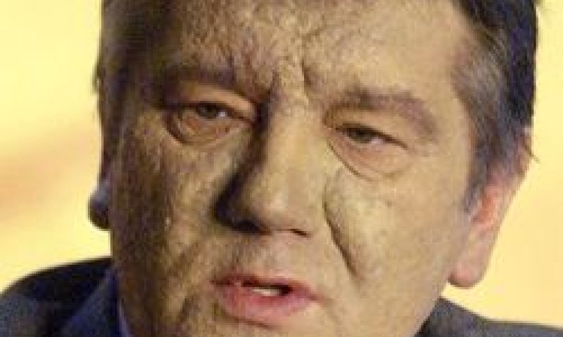 יושצ'נקו. להרגיע [צילום: AP]