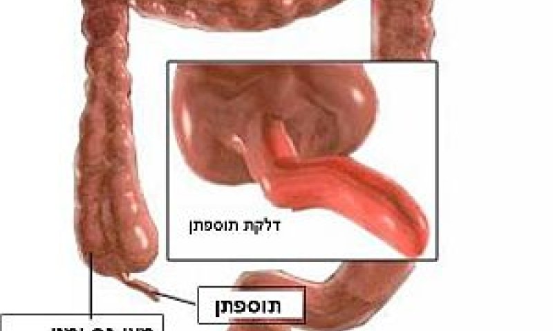 [צילום: יח"צ]