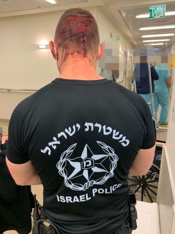 שוטר שנפצע בראשו [צילום: דוברות המשטרה]