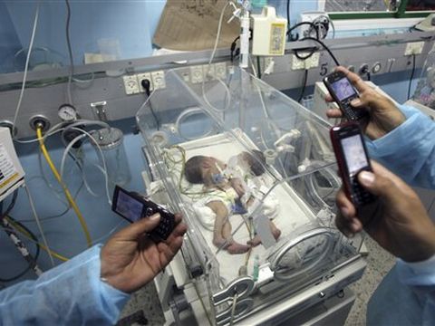 התאומות הסיאמיות בבית החולים [צילום: AP]