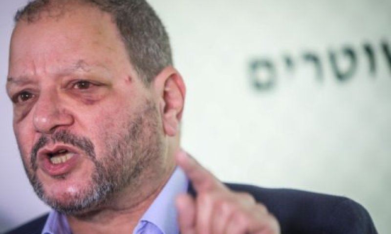 ח"כ עופר כסיף לאחר שהוכה בידי שוטרים [צילום: נועם ריבקין פנטון/פלאש 90]